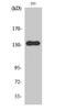 RACK7 antibody, STJ95320, St John