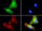 Phospholipid Transfer Protein antibody, GTX30230, GeneTex, Immunocytochemistry image 