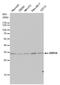 N(Alpha)-Acetyltransferase 10, NatA Catalytic Subunit antibody, PA5-32236, Invitrogen Antibodies, Western Blot image 