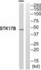 Serine/Threonine Kinase 17b antibody, A08711-2, Boster Biological Technology, Western Blot image 