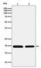 Ferritin Light Chain antibody, M01956-1, Boster Biological Technology, Western Blot image 