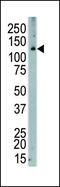 Colony Stimulating Factor 1 Receptor antibody, PA5-14569, Invitrogen Antibodies, Western Blot image 