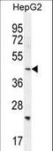 SH2 Domain Containing 4B antibody, LS-C169057, Lifespan Biosciences, Western Blot image 