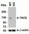 ADAM Metallopeptidase Domain 17 antibody, NBP1-77044, Novus Biologicals, Western Blot image 