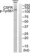 Colony Stimulating Factor 1 Receptor antibody, TA312197, Origene, Western Blot image 