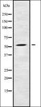 Cytochrome P450 2C9 antibody, orb336312, Biorbyt, Western Blot image 