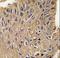 ANTXR Cell Adhesion Molecule 1 antibody, LS-C99436, Lifespan Biosciences, Immunohistochemistry paraffin image 