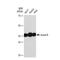 Aurora Kinase B antibody, GTX00916, GeneTex, Western Blot image 