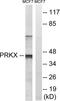 Protein Kinase X-Linked antibody, LS-C120367, Lifespan Biosciences, Western Blot image 