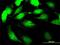 Signal Sequence Receptor Subunit 2 antibody, H00006746-M01, Novus Biologicals, Immunocytochemistry image 