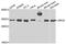 Origin Recognition Complex Subunit 6 antibody, STJ110273, St John