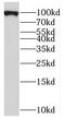 Glycogen phosphorylase, brain form antibody, FNab06974, FineTest, Western Blot image 