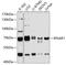 Interferon Alpha And Beta Receptor Subunit 1 antibody, 13-841, ProSci, Western Blot image 
