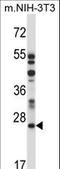 Lysosomal Protein Transmembrane 4 Alpha antibody, LS-C165683, Lifespan Biosciences, Western Blot image 