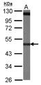 Tubulin Beta 4A Class IVa antibody, NBP1-32205, Novus Biologicals, Western Blot image 