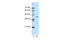 Docking Protein 2 antibody, 31-076, ProSci, Western Blot image 