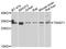 Twist Family BHLH Transcription Factor 1 antibody, STJ29453, St John