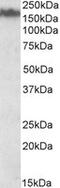 Neurofilament Medium antibody, MBS421706, MyBioSource, Western Blot image 