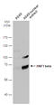 HNF1 Homeobox B antibody, GTX129236, GeneTex, Western Blot image 