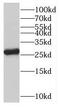 OVCA2 Serine Hydrolase Domain Containing antibody, FNab06046, FineTest, Western Blot image 