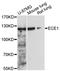 Endothelin Converting Enzyme 1 antibody, A5638, ABclonal Technology, Western Blot image 