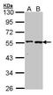 Glutamic--Pyruvic Transaminase antibody, GTX101559, GeneTex, Western Blot image 