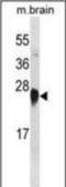 Potassium Voltage-Gated Channel Subfamily J Member 8 antibody, orb376703, Biorbyt, Western Blot image 