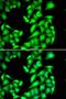 Protein Phosphatase, Mg2+/Mn2+ Dependent 1A antibody, LS-C334886, Lifespan Biosciences, Immunofluorescence image 