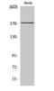 Collagen Type XI Alpha 2 Chain antibody, STJ92374, St John