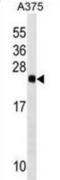 RAB2B, Member RAS Oncogene Family antibody, abx029877, Abbexa, Western Blot image 