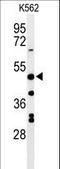 Rh Family B Glycoprotein (Gene/Pseudogene) antibody, LS-C162587, Lifespan Biosciences, Western Blot image 