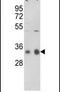 Protein Phosphatase 1 Catalytic Subunit Gamma antibody, PA5-15534, Invitrogen Antibodies, Western Blot image 