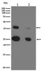 Cathepsin D antibody, M01361, Boster Biological Technology, Western Blot image 