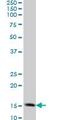 Translocase Of Outer Mitochondrial Membrane 20 antibody, ab56783, Abcam, Western Blot image 