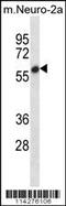 Histone methyltransferase SMYD2 antibody, 55-183, ProSci, Western Blot image 