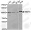 RNA Binding Motif Protein 15 antibody, A4936, ABclonal Technology, Western Blot image 