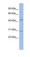 Activating Transcription Factor 7 antibody, orb331473, Biorbyt, Western Blot image 