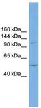 TNNI3 Interacting Kinase antibody, TA346505, Origene, Western Blot image 