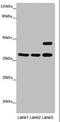 Major Histocompatibility Complex, Class I-Related antibody, orb45422, Biorbyt, Western Blot image 