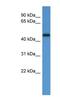 Ligand Dependent Nuclear Receptor Corepressor antibody, NBP1-69035, Novus Biologicals, Western Blot image 