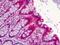 Schlafen Family Member 12 antibody, ab113238, Abcam, Immunohistochemistry paraffin image 