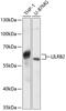 Leukocyte Immunoglobulin Like Receptor B2 antibody, 14-284, ProSci, Western Blot image 