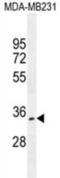 OTU Deubiquitinase 6A antibody, abx026548, Abbexa, Western Blot image 