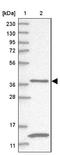 Galactose Mutarotase antibody, NBP1-85906, Novus Biologicals, Western Blot image 