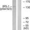 Insulin Receptor Substrate 1 antibody, PA5-38286, Invitrogen Antibodies, Western Blot image 