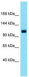 Signal Peptide, CUB Domain And EGF Like Domain Containing 1 antibody, TA337995, Origene, Western Blot image 