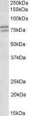 FMR1 Autosomal Homolog 1 antibody, GTX89272, GeneTex, Western Blot image 