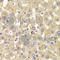 Membrane Bound Transcription Factor Peptidase, Site 1 antibody, A7025, ABclonal Technology, Immunohistochemistry paraffin image 