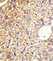 Casein Kinase 1 Gamma 3 antibody, A12301-1, Boster Biological Technology, Immunohistochemistry paraffin image 