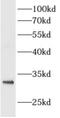 AlkB Homolog 3, Alpha-Ketoglutaratedependent Dioxygenase antibody, FNab00312, FineTest, Western Blot image 